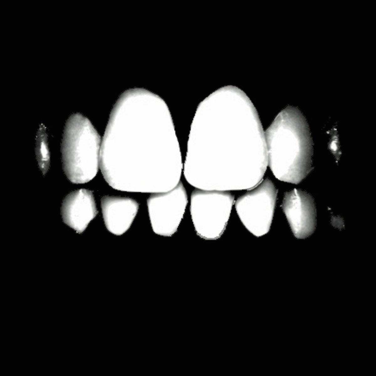 TONY SNAKE - EXTRASYSTOLE (Single 2006)